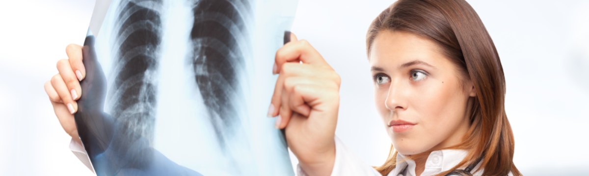  radiographie pulmonaire tabagisme